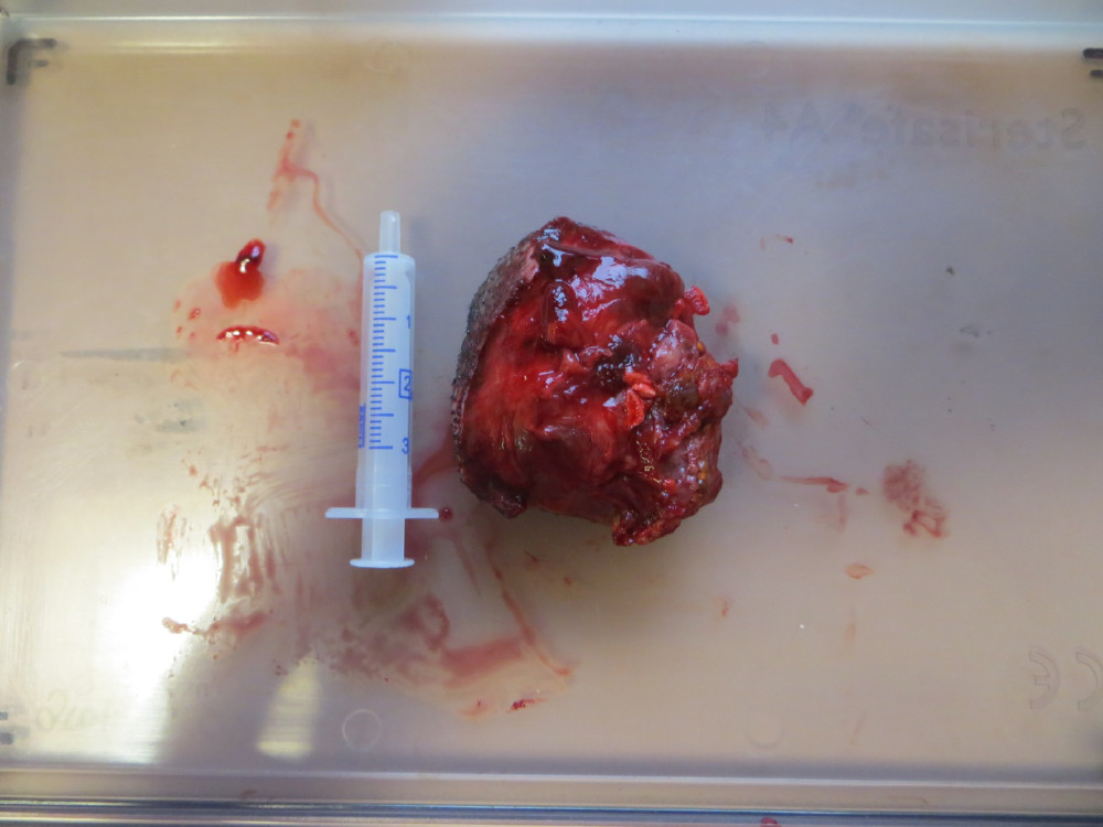 tumor pfote 3